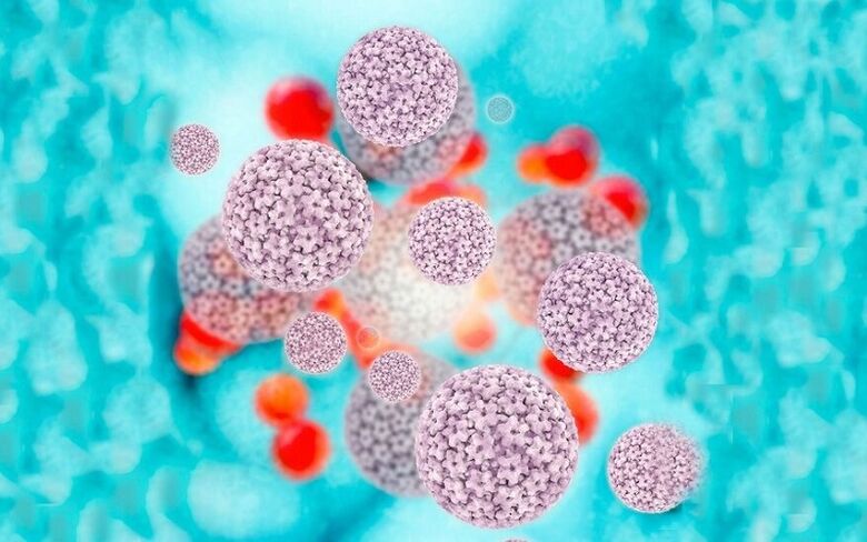 Mënschleche Papillomavirus verursaacht Papillome op de Schamlippen