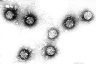 Mënschleche Papillomavirus