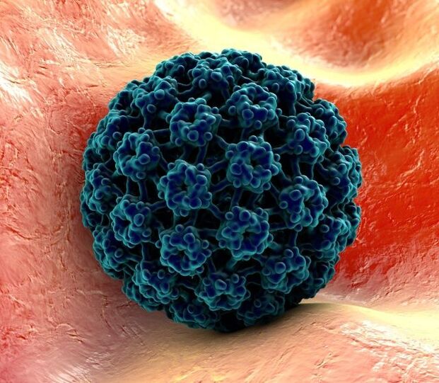 3D Modell vun HPV verursaacht Warzen op den Hänn